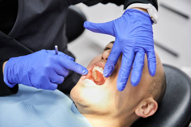 Best Knocked-Out Tooth (Avulsed Tooth) Treatment in Lillington, NC
